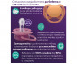 Ортодонтска залъгалка Philips-Avent Ultra Soft, 2 броя, със стерилизираща кутийка, лилав/оранжев, 18м+ 00A.0669.001 thumb 7